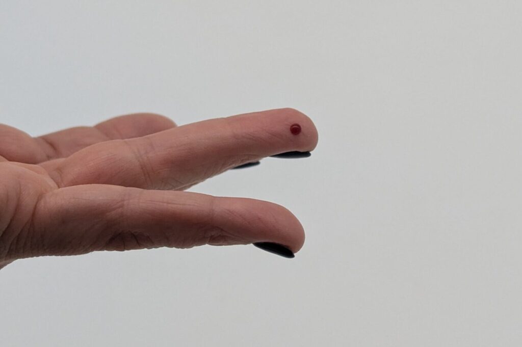 Hand mit Bluttropfen